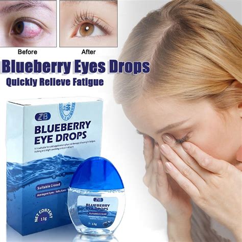 【cod】blueberry Eye Drops Itchy Eyes Glaucoma Eye Drops Dry Eyes