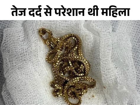 Rajasthan Woman Swallows Gold Chain Jaipur News चोरी के डर से सोने की चेन निगल गई महिला पेट