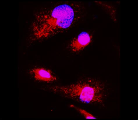 Neuroinflammation Antibody Panel IRAP5017 IReal Biotechnology Inc