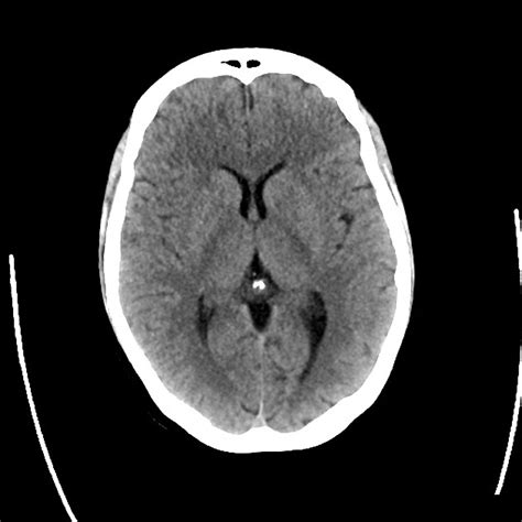 Ct Fmri Eeg