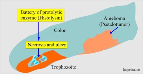 Amoebiasis Entamoeba Histolytica Life Cycle Diagnosis And Intestinal Amoebas