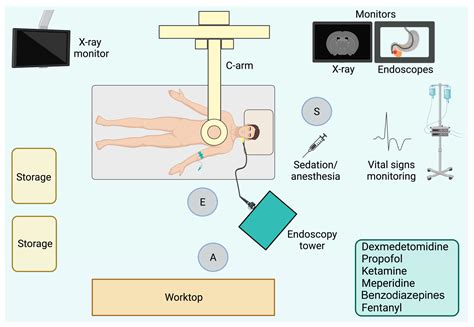 Novel Sedation Agent For Colonoscopy Meets Phase Iii Check Cap