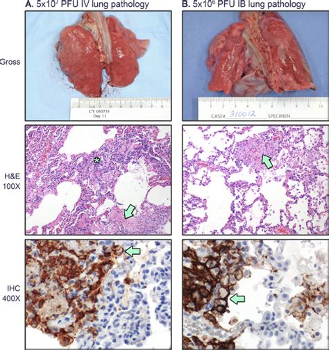 Lung Histology Normal