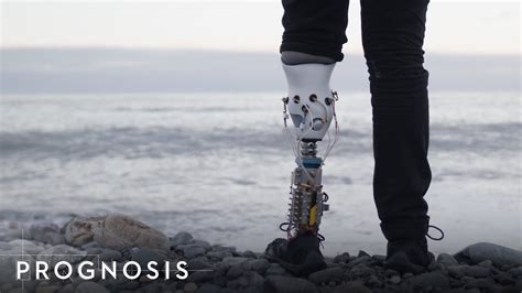 Building A Bionic Leg