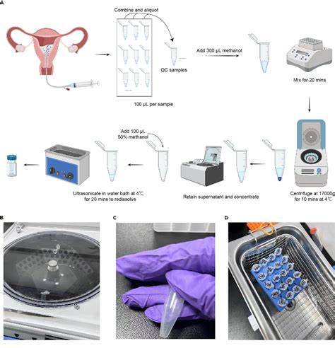 Figure 1 From Protocol For Identifying Metabolite Biomarkers In Patient