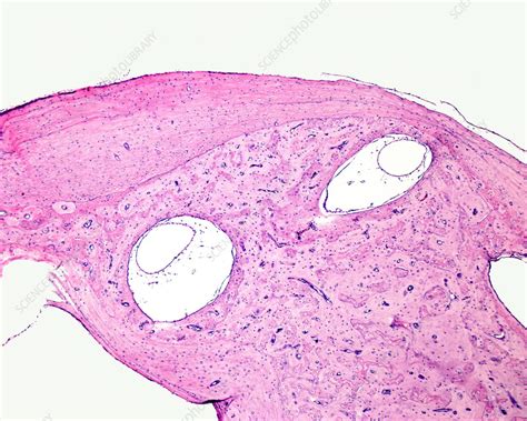 Semicircular Canals Light Micrograph Stock Image C