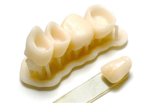 Dental Resin Harz Labs Filament Print