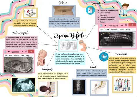 Infografía Espina bífida