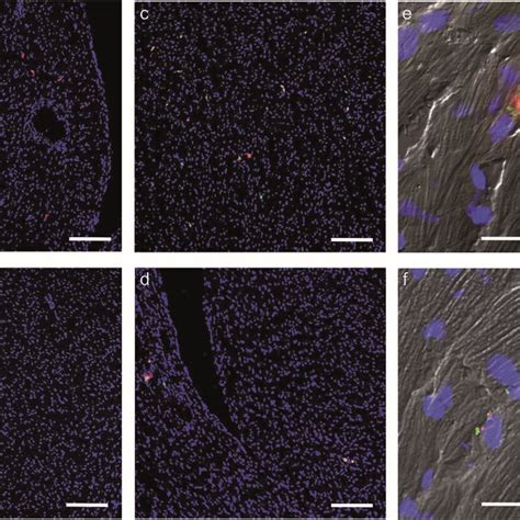 The Effect Of The Construct On HMSCs Homing And Retention In A Murine