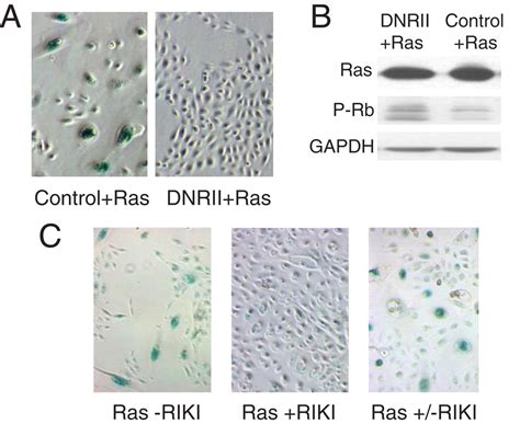 Attenuation Of Tgf Signaling Suppresses Premature Senescence In A P