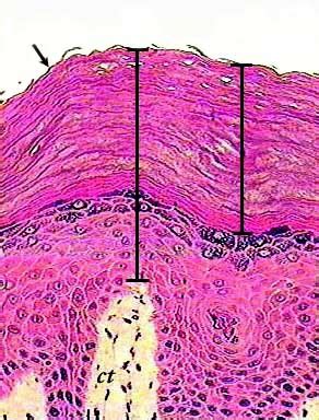 Histology Stratified Epithelium Flashcards Quizlet