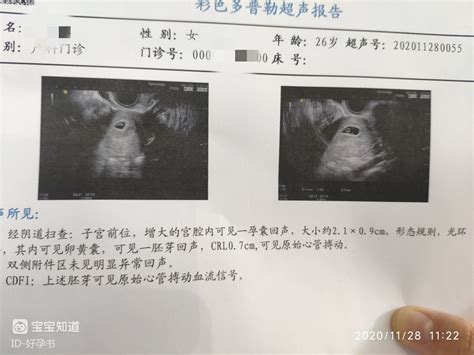 孕6周 4天记第一次阴道彩超检查宝宝像花生豆大 百度宝宝知道