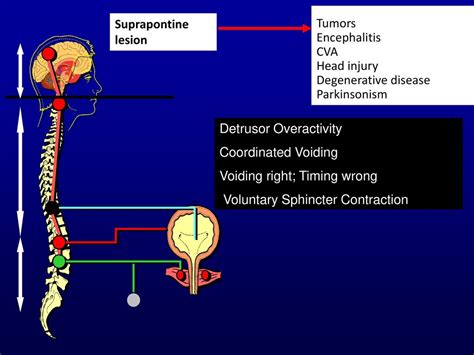 Step By Step Basic Neuro Urology Teaching Ppt Download