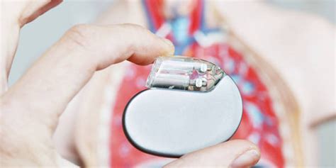 Impiantato Innovativo Pacemaker Defibrillatore Gazzetta Del Sud