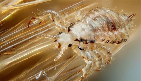 Head Lice Symptoms And Causes Home Remedies For Treating Head Lice