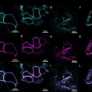 Confocal And Sted Images Of Ir Tag Gfp Expressing Hek T Cells