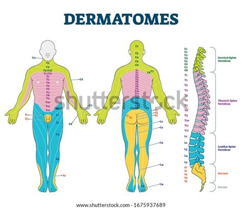 Ilustração vetorial de dermatomas. Esquema de: vetor stock (livre de ...