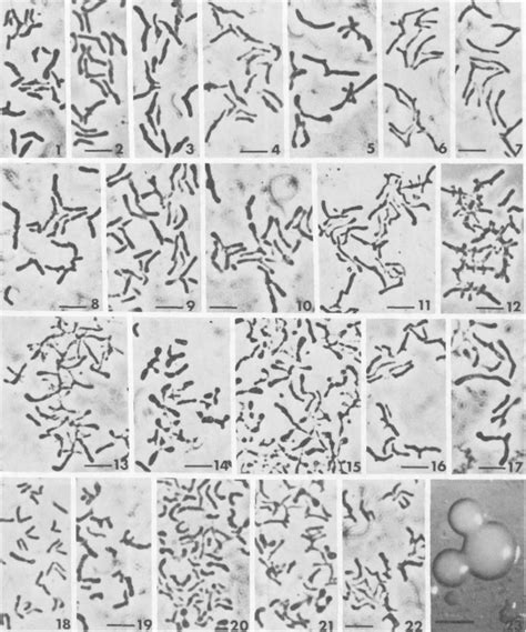 Figure 1 From Bifidobacterium Cuniculi Bifidobacterium Choerinum