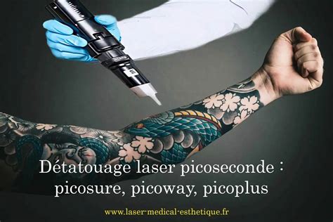 Détatouage laser picoseconde à l exemple de Picosure