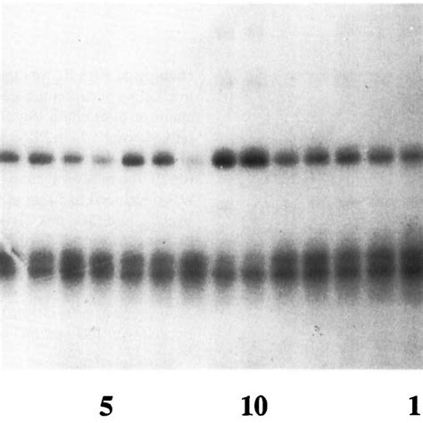 Autoradiograph Of Sds Polyacrylamide Gel After Electrophoresis Under