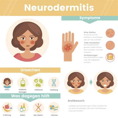 Neurodermitis ist sie ansteckend oder ungefährlich