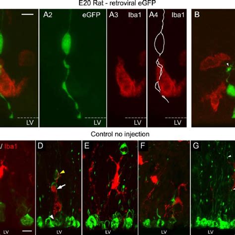 Microglial Cells Intimately Interact With Rg Cells A Egfp Expressing Download Scientific