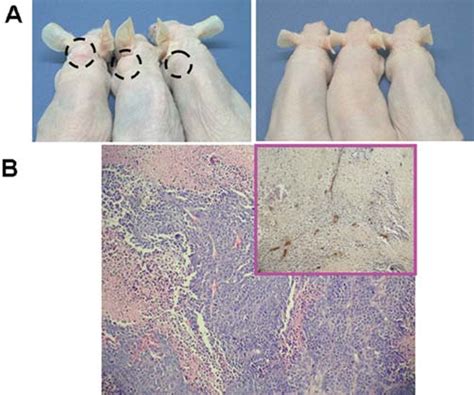 Subcutaneous Tumorigenicity Of Sphere Forming Cells In Nude Mice A