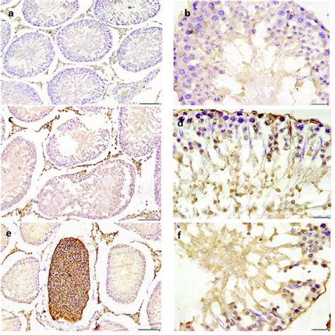 Photomicrographs Of Testicular Tissues Caspase 3 Immunostaining A B