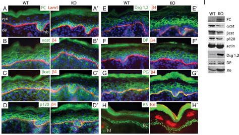 Figure 2 From Conditional Targeting Of E Cadherin In Skin Insights