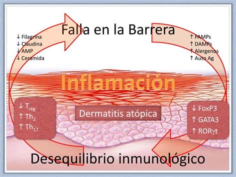 Diferencias Entre Dermatitis Atópica Y Urticaria Prof Ortega Martell