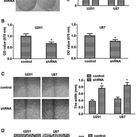 Nucb Promotes The Proliferation And Invasion Of Glioblastoma Cells In