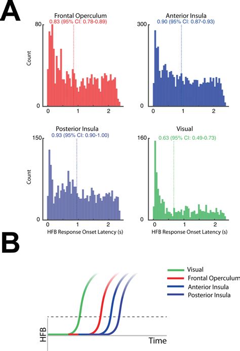 Comparison Of Hfb Response Onset By Anatomical Location During Task