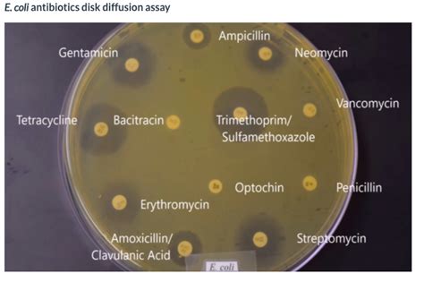 Solved E Coli Antibiotics Disk Diffusion Assay Ampicillin Chegg