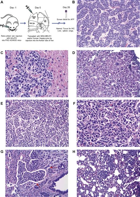 Murine Model Of Hepatic Breast Cancer Abstract Europe Pmc