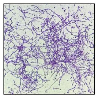 Representative photomicrograph of Gram stain of isolated Streptomyces... | Download Scientific ...