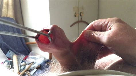 Baby Oil Foreskin Video Barbecue Tongs British Gay Amateur Porn Xhamster