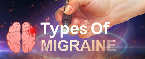 Different Types of Migraine and How to Know Which You Have | Synergy ...