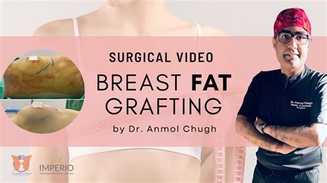 Breast Fat Grafting Breast Implants Or Breast Fat Transfer Plastic