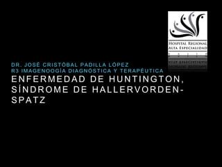 Hallazgos Radiologicos En Enfermedad De Huntington S Ndrome De