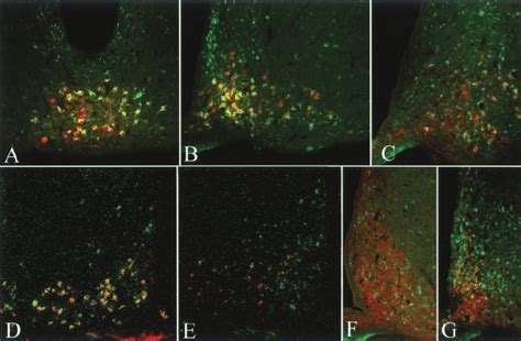 Colocalization Of Vgf With ␣ Msh And Npy In The Arcuate Nucleus Of Fed