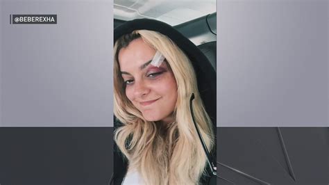 Singer Bebe Rexha Says She S OK After Being Hit In The Face On Stage By