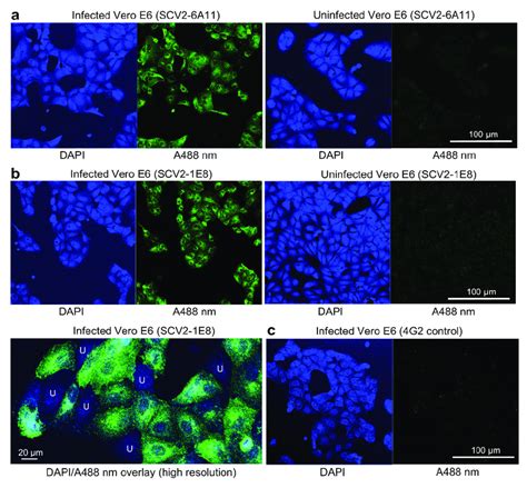 Indirect Immunofluorescence Assay Ifa Staining A Vero E6 Cells