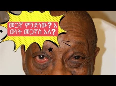 መጋኛ ምንድነው እውን መጋኛ የሚባል አለ የፊት መጣመም መንስኤዎች Bells palsy Facial