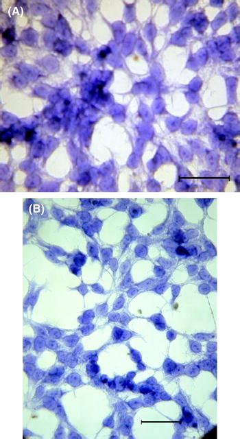 HEK 293 cell morphology: a—in control (medium supplemented with 5 % FCS... | Download Scientific ...