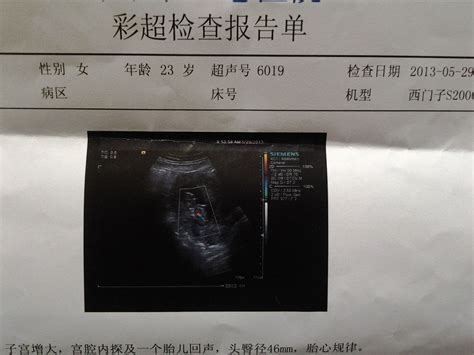 彩超单看胎儿性别，专家进 孕期，将近12周 百度宝宝知道