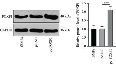 Ev Carried Mir 375 Inhibits The Fibrosis Of Fbmfs Via Targeting Foxf1