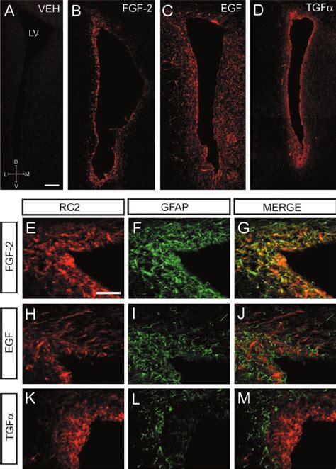 Infusion Of EGF Or TGF But Not FGF 2 Into The Lateral Ventricles