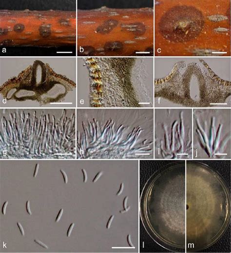 Cytospora Ampulliformis Facesoffungi Number Fof 02736 Faces Of Fungi