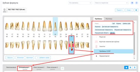Принцип работы в зубной формуле | DentalPRO