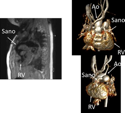 Society For Cardiovascular Magnetic Resonance European Society Of